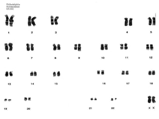 Nuestros cromosomas y sus alteraciones sc2008