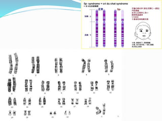 Nuestros cromosomas y sus alteraciones sc2008