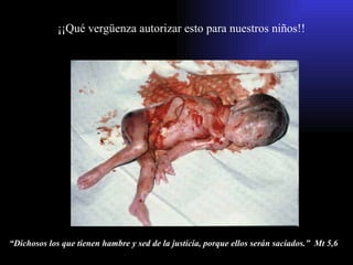 “ Dichosos los que tienen hambre y sed de la justicia, porque ellos serán saciados.”  Mt 5,6 ¡¡Qué vergüenza autorizar esto para nuestros niños!! 