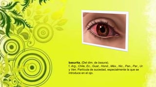 basurita. (Del dim. de basura).
f. Arg., Chile, Ec., Guat., Hond., Méx., Nic., Pan., Par., Ur.
y Ven. Partícula de suciedad, especialmente la que se
introduce en el ojo.
 