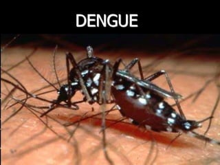 DENGUE
 