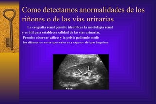 Como detectamos anormalidades de los riñones o de las vías urinarias La ecografia renal permite identificar la morfología renal  y es útil para establecer calidad de las vías urinarias. Permite observar cálices y la pelvis pudiendo medir los diámetros anteroposteriores y espesor del parénquima 