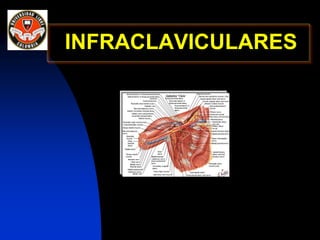 INFRACLAVICULARES
 