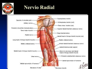 Nervio Radial
 