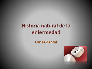 Historia natural de la
enfermedad
Caries dental
 