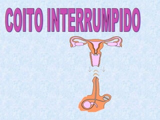 COITO INTERRUMPIDO 