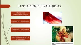 INDICACIONES TERAPEUTICAS
Infecciones
complicadas de piel

Apendicitis Complicada

Colecistitis Complicada

Perforación intestinal y
ulceraciones

 