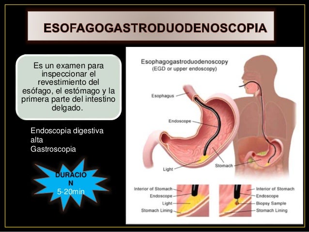 ESOFAGOGASTRODUODENOSCOPIA Y LAPAROSCOPIA