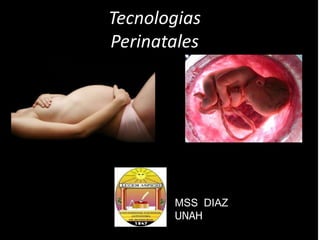 Tecnologias
Perinatales




       MSS DIAZ
       UNAH
 