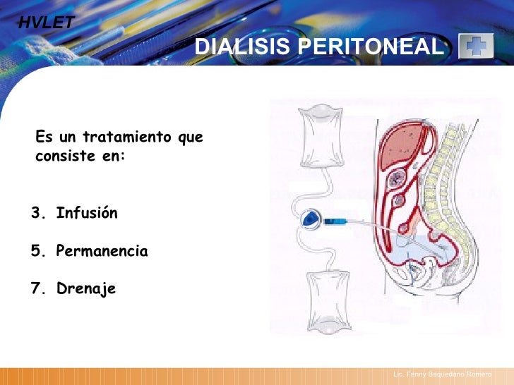Nuevos enfoques en dialisis peritoneal lobitoferoz13