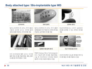 Body attached type / Bio-implantable type WD

58

NUI / WD / IR 기술동향 및 전망

 