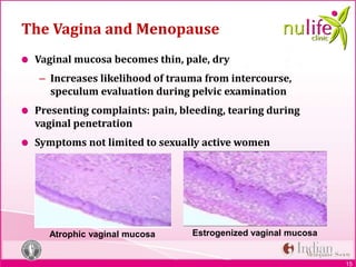 15
The Vagina and Menopause
Vaginal mucosa becomes thin, pale, dry
– Increases likelihood of trauma from intercourse,
speculum evaluation during pelvic examination
Presenting complaints: pain, bleeding, tearing during
vaginal penetration
Symptoms not limited to sexually active women
15
Atrophic vaginal mucosa Estrogenized vaginal mucosa
 