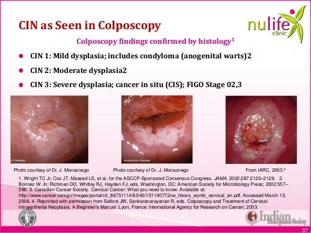 Nulife module 6 screening for malignancies edited