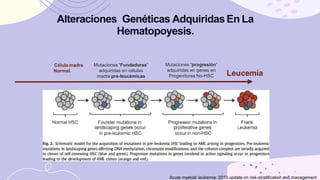 Leucemia Mieloide aguda.pptx