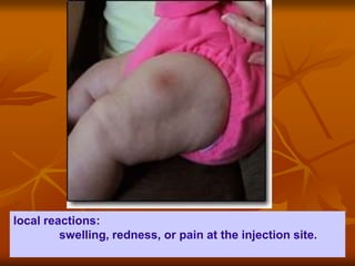 local reactions:
swelling, redness, or pain at the injection site.
 