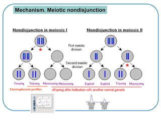 Electrophoresis profiles
Mechanism. Meiotic nondisjunction
 
