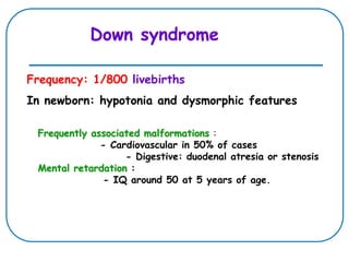 Frequency: 1/800 livebirths
In newborn: hypotonia and dysmorphic features
Down syndrome
Frequently associated malformations :
- Cardiovascular in 50% of cases
- Digestive: duodenal atresia or stenosis
Mental retardation :
- IQ around 50 at 5 years of age.
 