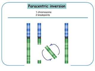 Paracentric inversion
1 chromosome
2 breakpoints
 