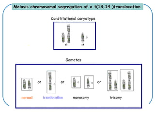 Meiosis chromosomal segregation of a t(13;14 )translocation
Constitutional caryotype
Gametes
monosomy trisomy
or or or
 