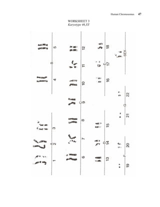 Human Chromosomes 47
WORKSHEET 3
Karyotype 46,XY
 