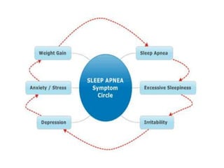 Obstructive Sleep Apnea and obesity