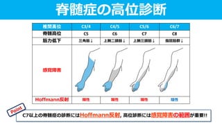 椎間高位 C3/4 C4/5 C5/6 C6/7
脊髄高位 C5 C6 C7 C8
筋力低下 三角筋↓ 上腕二頭筋↓ 上腕三頭筋↓ 指屈筋群↓
感覚障害
Hoffmann反射 陽性 陽性 陽性 陰性
脊髄症の高位診断
C7以上の脊髄症の診断にはHoffmann反射, 高位診断には感覚障害の範囲が重要!!
 