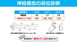 椎間高位 C5/6 C6/7 C8/T1
神経根 C6 C7 C8
一番痺れている指 母指 示指, 中指 小指
痺れの部位が腕のデルマトームに一致 指でOKを作った範囲がC6
神経根症の高位診断
高位診断は一番痺れている指で鑑別する!!
 