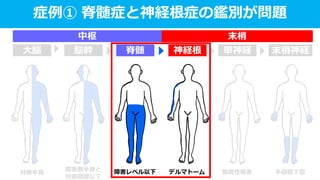 対側半身
障害側半身と
対側頸部以下
障害レベル以下 デルマトーム 限局性障害 手袋靴下型
症例① 脊髄症と神経根症の鑑別が問題
末梢神経単神経神経根脊髄脳幹大脳
中枢 末梢
 