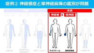 対側半身
障害側半身と
対側頸部以下
障害レベル以下 デルマトーム 限局性障害 手袋靴下型
症例② 神経根症と単神経麻痺の鑑別が問題
末梢神経単神経神経根脊髄脳幹大脳
中枢 末梢
 