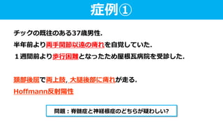 チックの既往のある37歳男性.
半年前より両手関節以遠の痺れを自覚していた.
１週間前より歩行困難となったため屋根瓦病院を受診した.
頚部後屈で両上肢, 大腿後部に痺れが走る.
Hoffmann反射陽性
症例①
問題：脊髄症と神経根症のどちらが疑わしい?
 