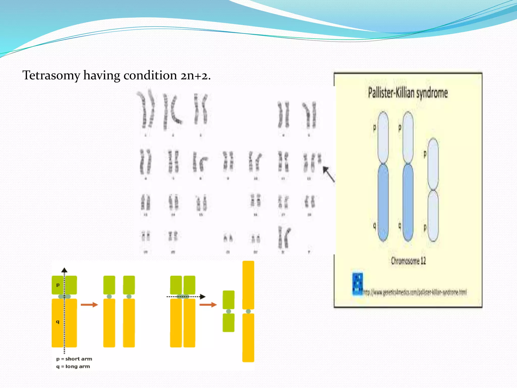 Tetrasomy having condition 2n+2.
