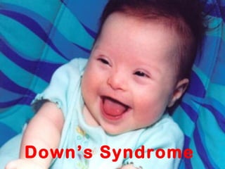 Down’s Syndrome
 