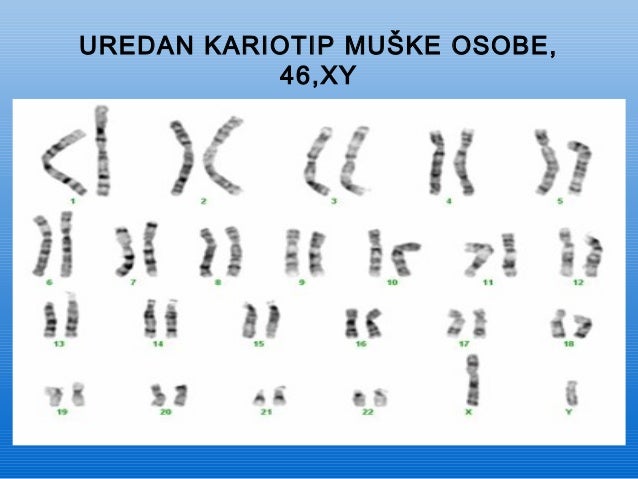 kariogram