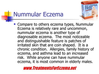 Nummular Eczema ,[object Object],eczema nummular,for nummular eczema,is nummular eczema,nummular eczema, nummular eczema pictures,nummular eczema treatment,nummular exzema,numular eczema,of nummular eczema 