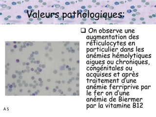 A S
Valeurs pathologiques:
 On observe une
augmentation des
réticulocytes en
particulier dans les
anémies hémolytiques
aigues ou chroniques,
congénitales ou
acquises et après
traitement d’une
anémie ferriprive par
le fer on d’une
anémie de Biermer
par la vitamine B12
 