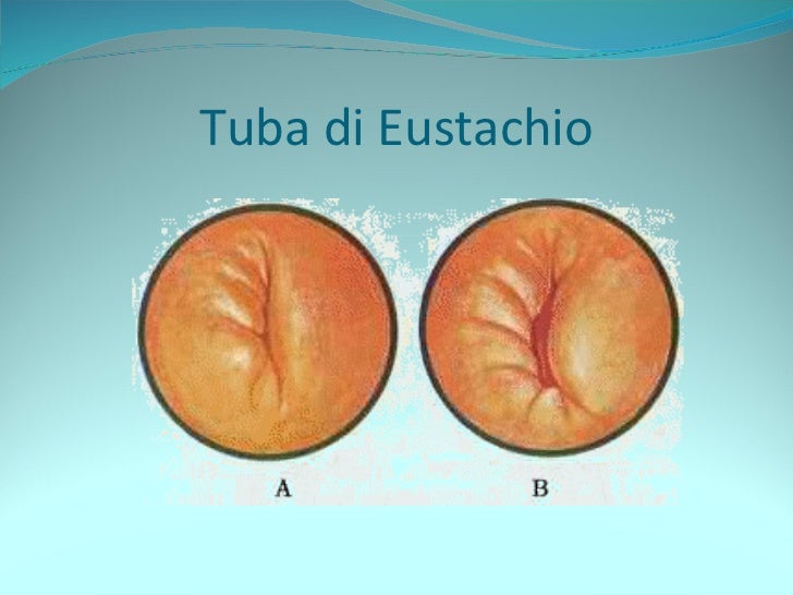 Le vie aeree superiori