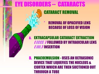 EYE DISORDERS -- CATARACTS
CATARACT REMOVAL
* REMOVAL OF OPACIFIED LENS
BECAUSE OF LOSS OF VISION
A. EXTRACAPSULAR CATARACT EXTRACTION
( ECCE ) FOLLOWED BY INTRAOCULAR LENS
( IOL ) INSERTION
B. PHACOEMULSION - USES AN ULTRASONIC
DEVICE THAT LIQUEFIES THE NUCLEUS &
CORTEX WHICH ARE THEN SUCTIONED OUT
THROUGH A TUBE
 