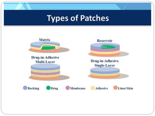 An Overview of Transdermal Drug Delivery System (TDDS) | PPTX