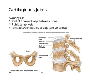 Cartilaginous Joints
• Symphysis:
• Pad of fibrocartilage between bones
• Pubic symphysis
• Joint between bodies of adjacent vertebrae
Copyright © The McGraw-Hill Companies, Inc. Permission required for reproduction or display.
Gelatinous
core
Spinous process
Band of
fibrocartilage
Pubis
Fibrocartilage disc of symphysis pubis
Intervertebral
discs
(a) (b)
Body of
vertebra
 