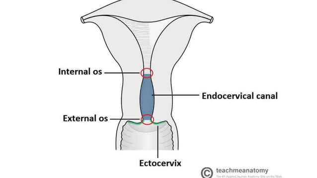 Female genital system: Fibroid, cervical cancer, endometrial cancer