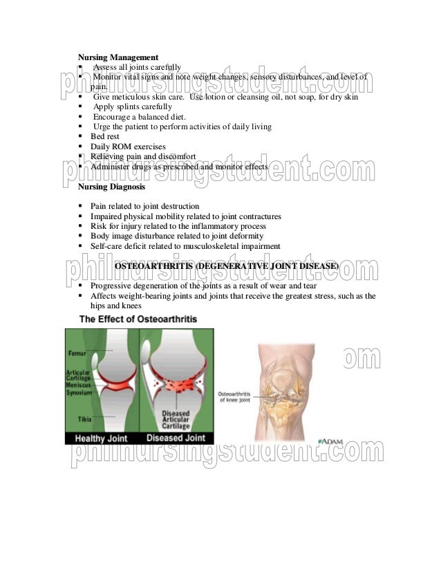 Musculoskeletal disorders case study 32 picture