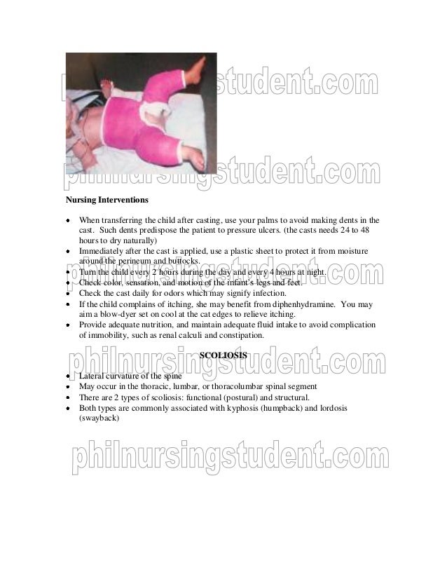 Musculoskeletal diseases examples image