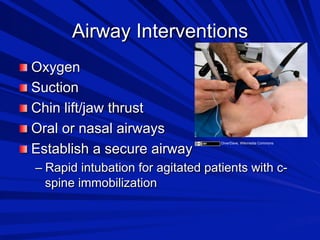 Airway Interventions

 Oxygen

 Suction

 Chin lift/jaw thrust

 Oral or nasal airways

 Establish a secure airway
–  Rapid intubation for agitated patients with cspine immobilization
DiverDave, Wikimedia Commons

 