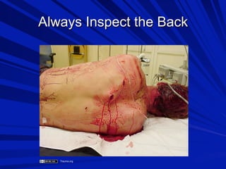 Always Inspect the Back

Trauma.org

 