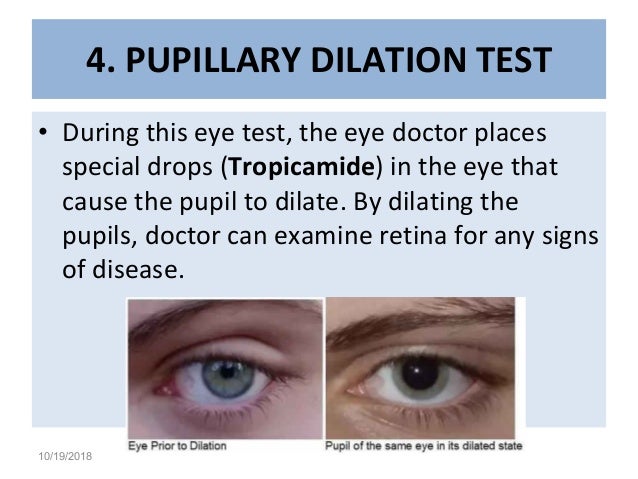 Eye Dilation Chart