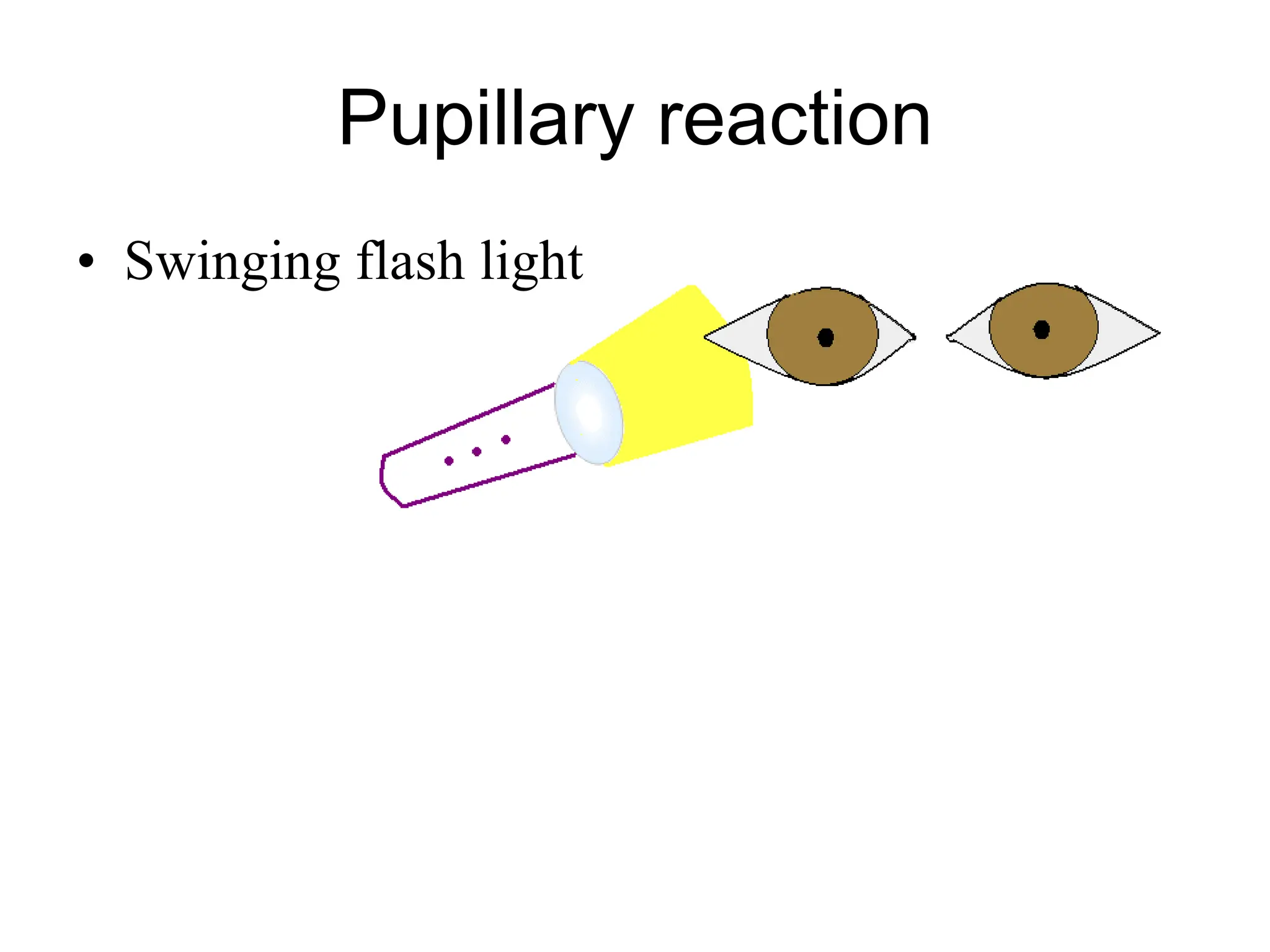 Pupillary reaction Swinging flash light 