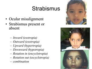 Inward Rotation Of Eye Nursing assessment of eye part1 | PPT