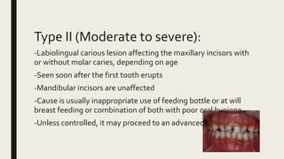 Type II (Moderate to severe):
-Labiolingual carious lesion affecting the maxillary incisors with
or without molar caries, depending on age
-Seen soon after the first tooth erupts
-Mandibular incisors are unaffected
-Cause is usually inappropriate use of feeding bottle or at will
breast feeding or combination of both with poor oral hygiene
-Unless controlled, it may proceed to an advanced stage.
 