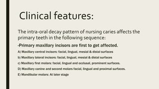 Clinical features:
The intra-oral decay pattern of nursing caries affects the
primary teeth in the following sequence:
-Primary maxillary incisors are first to get affected.
A) Maxillary central incisors: facial, lingual, mesial & distal surfaces
b) Maxillary lateral incisors: facial, lingual, mesial & distal surfaces
c) Maxillary first molars: facial, lingual and occlusal, prominent surfaces.
D) Maxillary canine and second molars facial, lingual and proximal surfaces.
E) Mandibular molars: At later stage
 