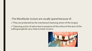-The Mandibular incisors are usually spared because of:
✓They are protected by the mechanical cleansing action of the tongue
✓ Cleansing action of saliva due to presence of the orifice of the duct of the
sublingual glands very close to lower incisors
 